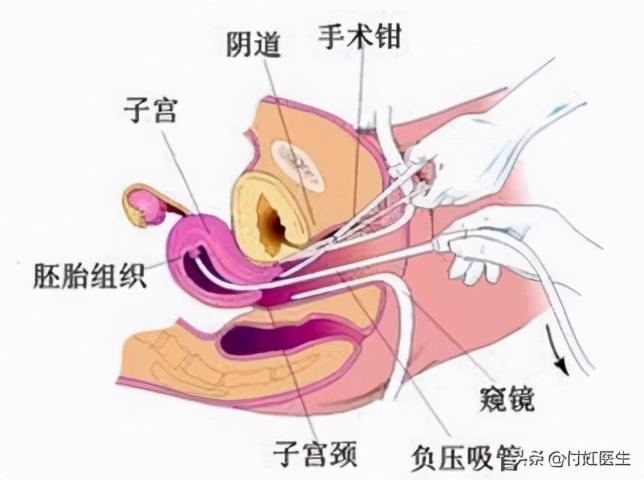 月经几个月来一次的原因及其影响，深度解析与应对建议