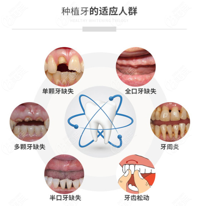 广东省口正颌费用详解